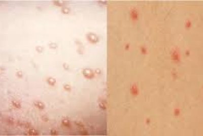 Trường Mầm Non Nghĩa Minh xã Đồng Thịnh – Phòng chống bệnh chân tay miệng cho trẻ ở trường mầm non .